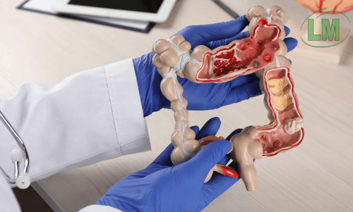 DENUNCIAN QUE UNA PREPAGA DEJÓ SIN COBERTURA A UN PACIENTE CON CÁNCER DE COLON Y NO ACATA LA ORDEN JUDICIAL